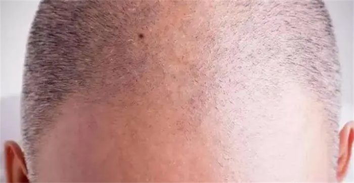 ؔײز¶иŮFʳon