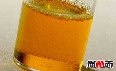 低智商的九種表現(xiàn)