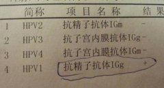 精元抗體是什么意思?GPAL化驗(yàn)單了解女性幾個前任?